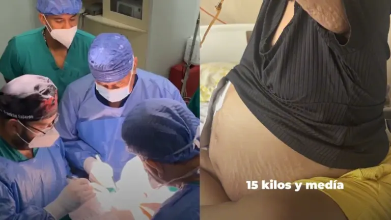 Increíble cirugía en Guayaquil transforma vida de paciente